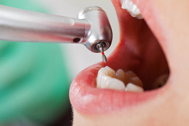 Best Broken or Chipped Tooth Repair in Pecatonica, IL